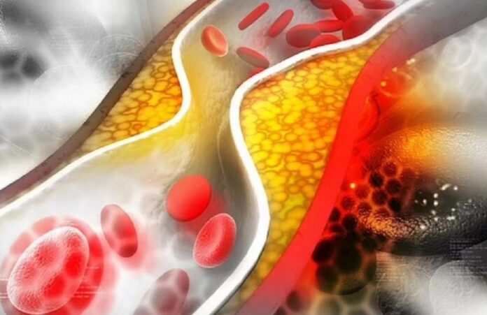 The Impact of Weight Loss on Cardiovascular Health The Impact of Weight Loss on Cardiovascular Health
